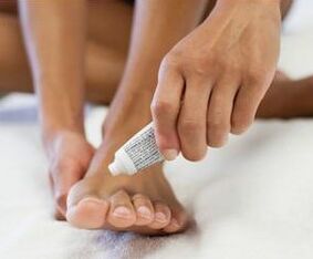 Treatment of fungus